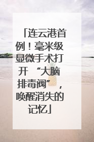 连云港首例！毫米级显微手术打开 “大脑排毒阀”，唤醒消失的记忆